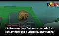             Video: Sri Lanka enters Guinness World Records for removing the world's Largest Kidney Stone
      