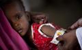             At least 56,000 children in Sri Lanka suffering from malnutrition
      