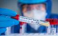             Concerns raised over imported Rapid Antigen Test kits
      